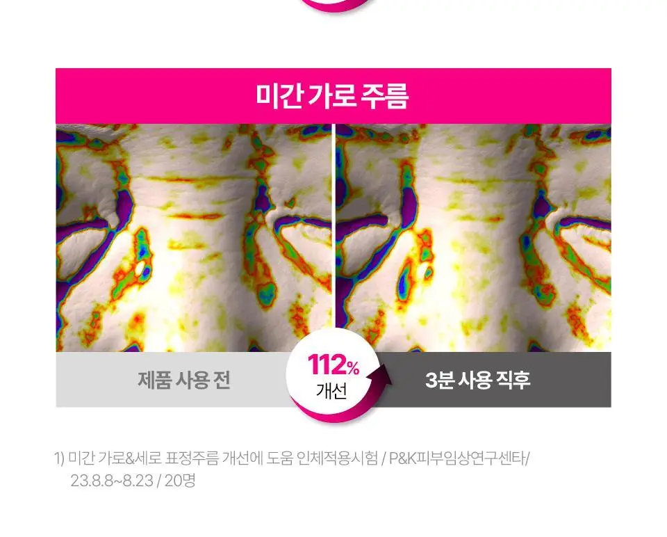 [퀭한눈가패치] 아이소이 블레미쉬 케어 아이&미간 패치 90매 더블 기획 상세페이지 12